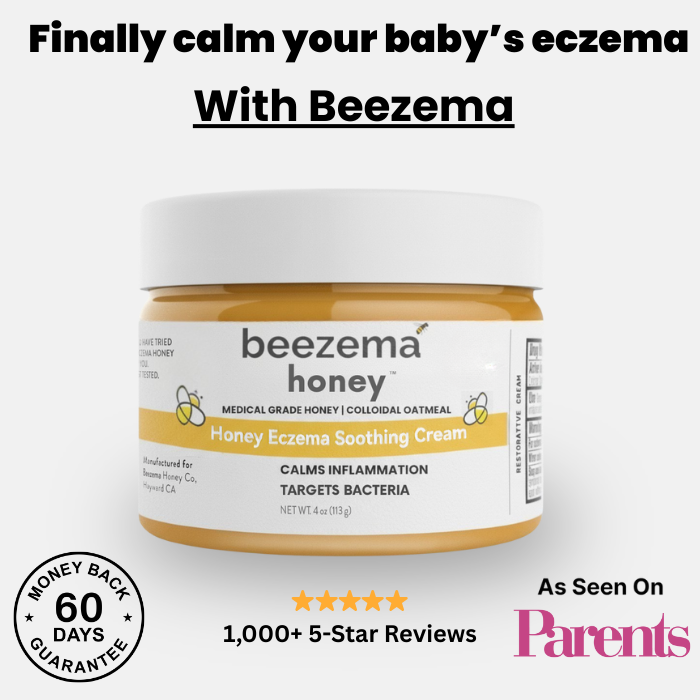 babee eczema cream
